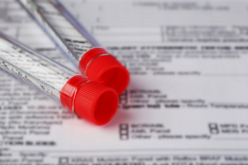 Ensuring Safe Blood Sample Transportation Strategies with R Courier